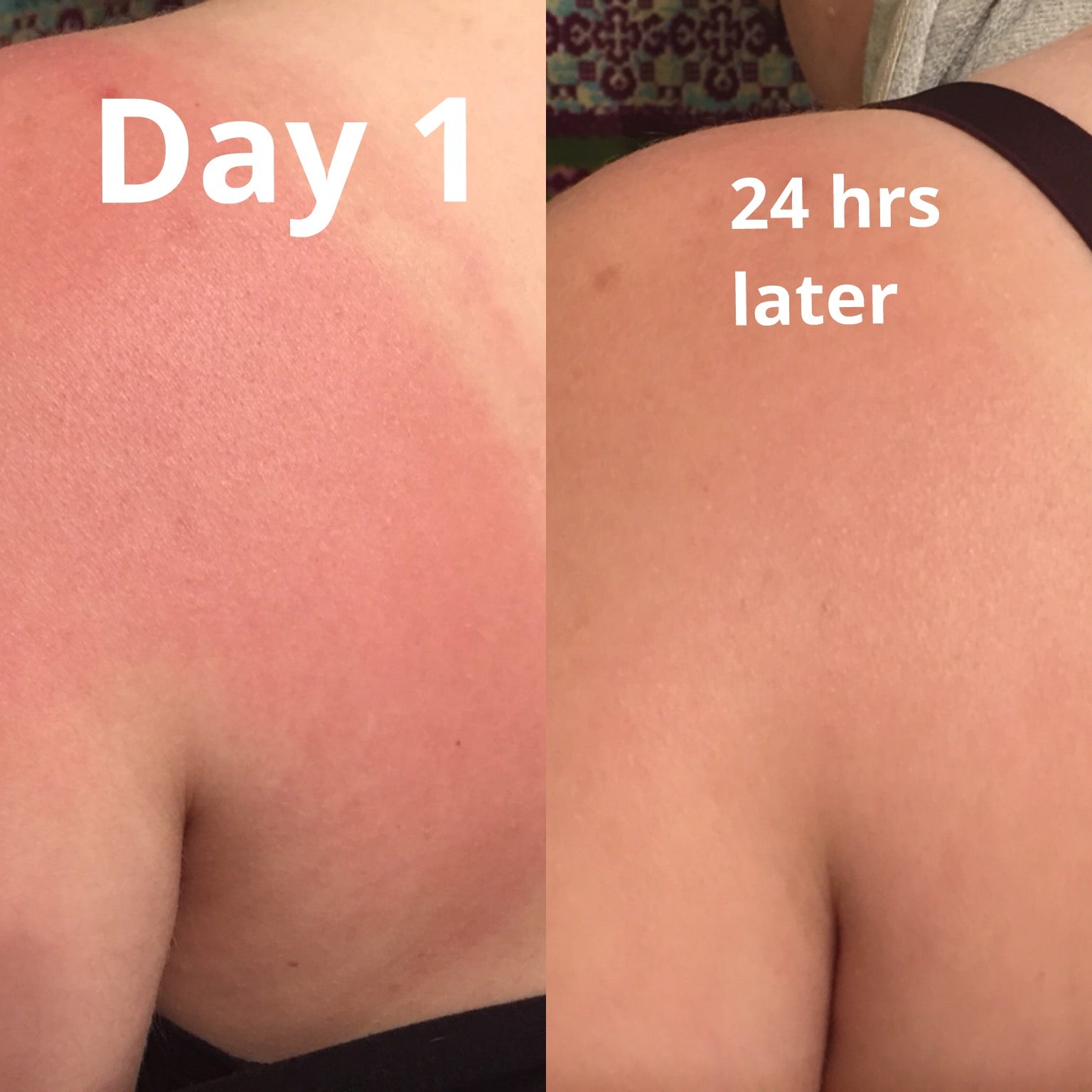 Sunburn Relief Spray - Witchy Woman Herbal Co